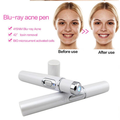 Blue Light Therapy Acne Laser Pen Soft Scar Wrinkle Removal