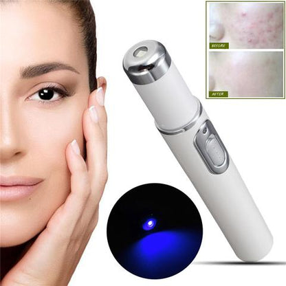 Blue Light Therapy Acne Laser Pen Soft Scar Wrinkle Removal